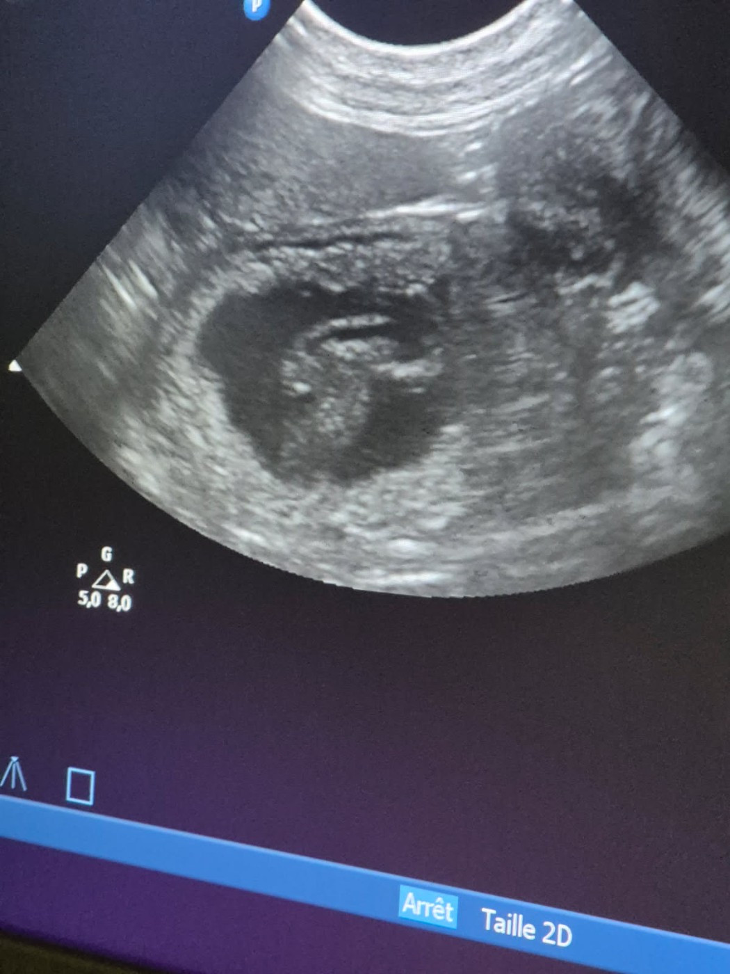 Confirmation gestation